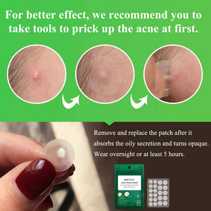 BREYLEE Tea Tree Acne Patch Hydrocolloid Acne Dots (3 Pack Day and Night, 66 Count) Invisible Spot Cover for Acne Absorbing, Pimple Healing, and Blemish Spot Treatment